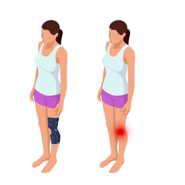 Diz ağrısı veya diz eklemi burkulma. Anatomik vücut bir adam. Travma sonrası rehabilitasyon. Ortopedi ve Tıp. İzometrik vektör çizim
