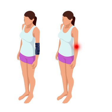 Ayarlanabilir Immobilizer kemikler ve kaslar hasar ve yaralanmalar için. El kırığı, germe veya el bağ rüptürü. Travma sonrası rehabilitasyon. Ortopedi ve Tıp. İzometrik vektör