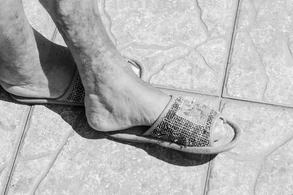Legs of an old woman wearing sleepers - black and white