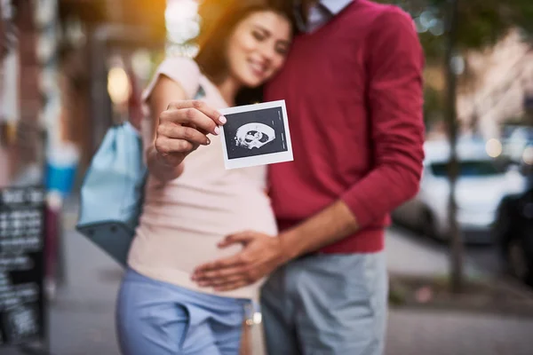 Foto ad ultrasuoni del bambino con felici genitori in attesa su sfondo sfocato — Foto Stock