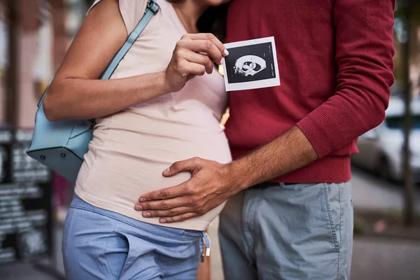 Lyckliga blivande föräldrar visar ultraljudsundersökning av deras baby — Stockfoto