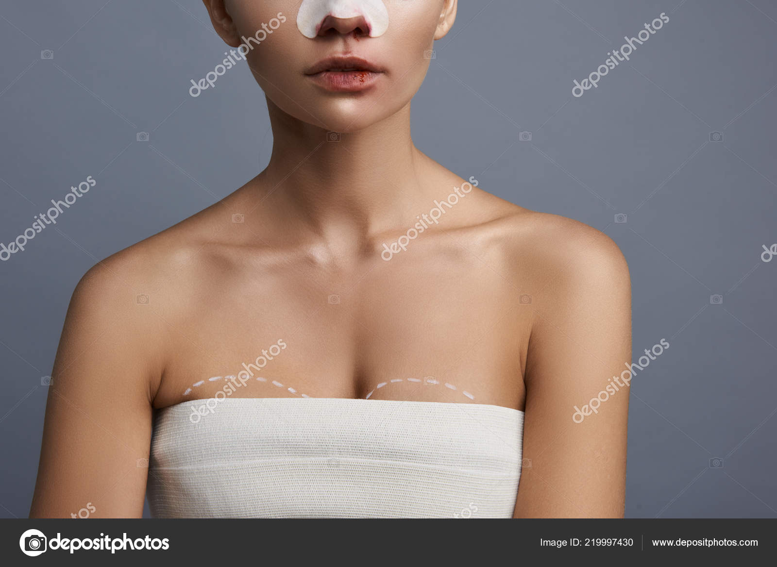 Something preparing for breast augmentation something For that preparing for breast augmentation something