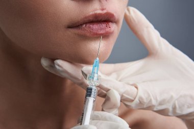 Genç bayanın kanlı dudaklarını içine enjeksiyon yakın çekim