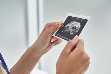 Bebek ultrason resmini tutan eller