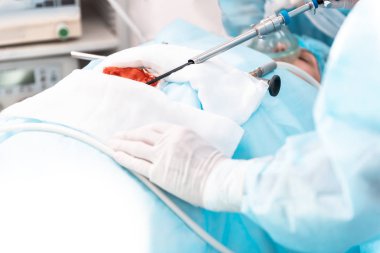 Böbrek işlem süreci ile modern aletleri yakın çekim