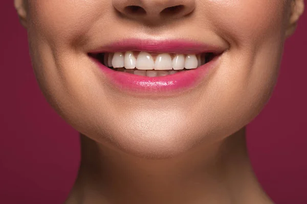 Dientes de mujer sonriente y lápiz labial rosa en sus labios —  Fotos de Stock