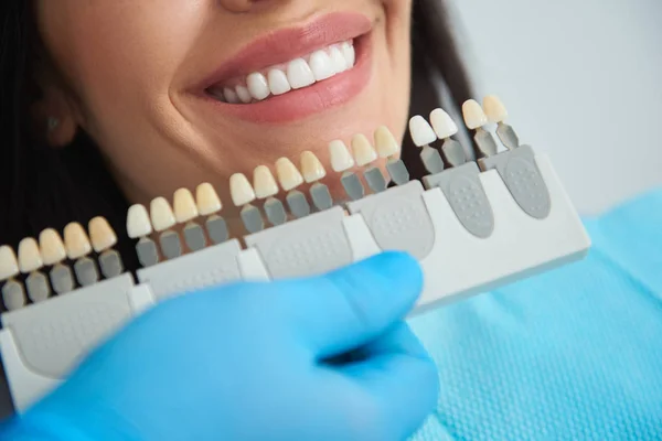 Corona dental situada cerca de la boca de la mujer joven — Foto de Stock