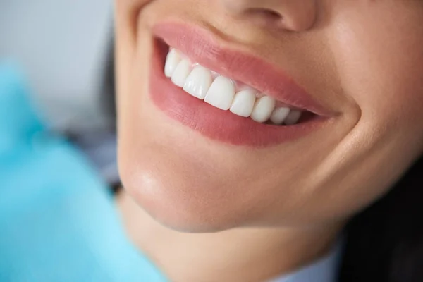 Primer plano de la sonrisa femenina blanca como la nieve en la clínica dental — Foto de Stock
