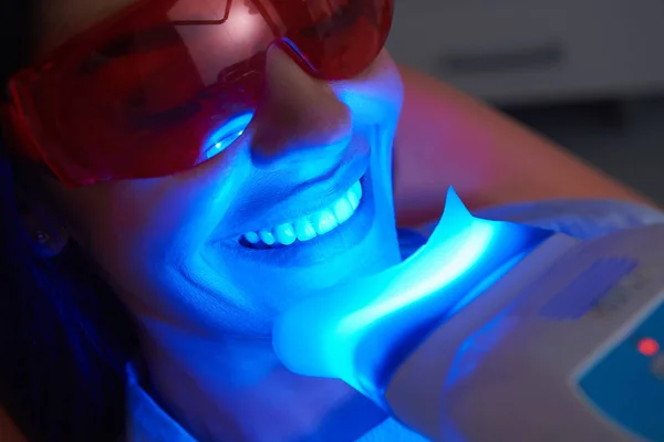 Adult woman is doing teeth whitening procedure — Stock Photo, Image