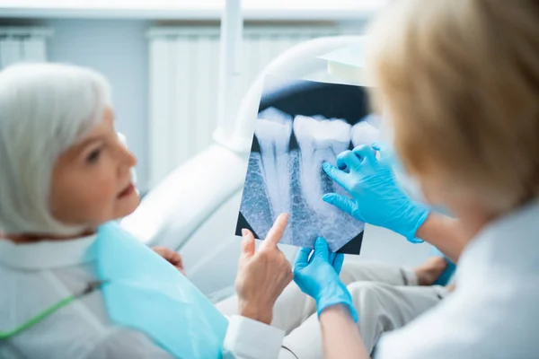 Mulher adulta está discutindo raio-x na clínica — Fotografia de Stock