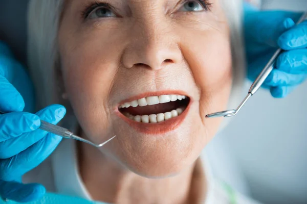 Tandläkare som innehar Dental Mirror och Explorer i händerna — Stockfoto