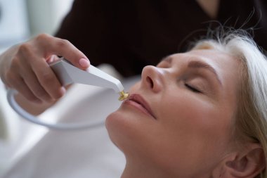 Kozmetik uzmanı dudaklarındaki kırışıklıkları gidermek için bir cihaz kullanıyor.