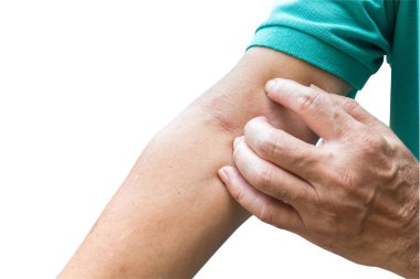 Alerjik deri üzerinde beyaz arka plan izole tırmalamak adam. Bu kırpma yolu vardır