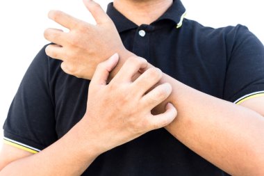 Alerjik deri üzerinde beyaz arka plan izole tırmalamak adam