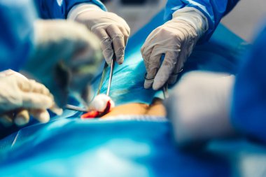 Profesyonel anestezi uzmanı doktor tıp ekibi ve asistanı modern hastane acil servisinde cerrahi ekipmanla jinekolojik ameliyata hazırlanıyor.