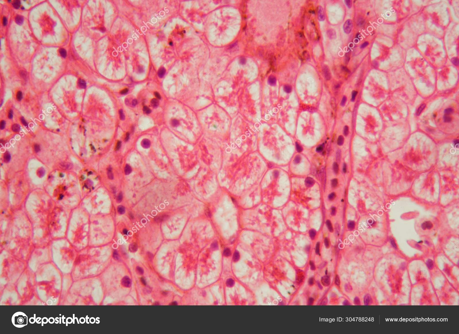 Microscope photo of a section through a frog liver. — Stock Photo