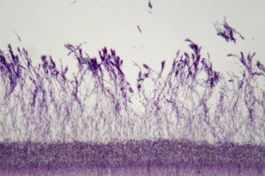 Mikroskop fotoğraf Penisillium mantarbir paket
