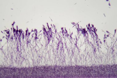 Mikroskop fotoğraf Penisillium mantarbir paket