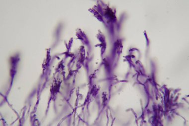 Mikroskop fotoğraf Penisillium mantarbir paket