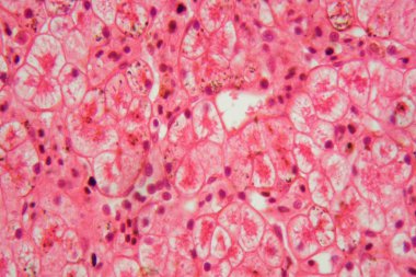 Kurbağa ciğerinden geçen bir bölümün mikroskop fotoğrafı. Bir kurbağa karaciğer hücreleri aracılığıyla bir bölümün Mikroskop fotoğrafı.