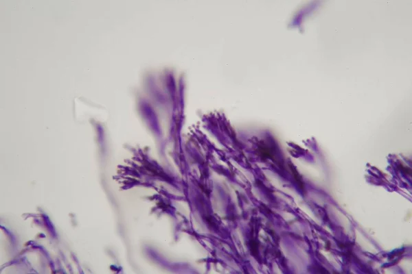 Fotografie mikroskopu, svazek plísní rodu Penicillium — Stock fotografie