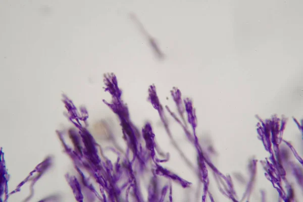 Fotografie mikroskopu, svazek plísní rodu Penicillium — Stock fotografie