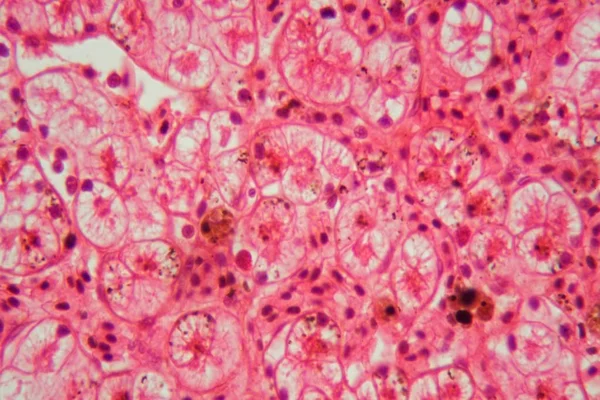 穿过青蛙肝的一段的显微镜照片. — 图库照片