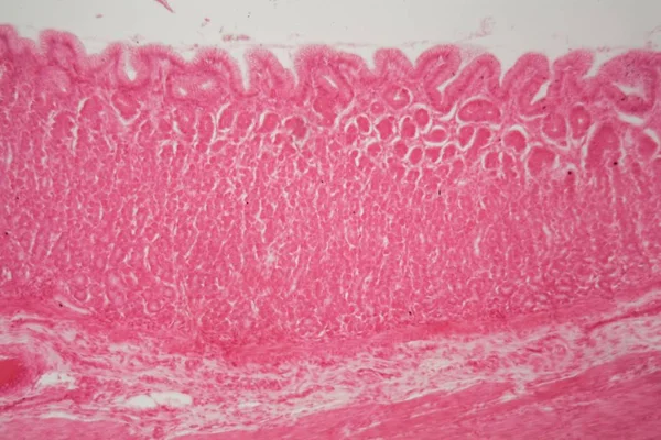 Τμήμα της πυλοφαινική περιοχή του στομαχιού — Φωτογραφία Αρχείου