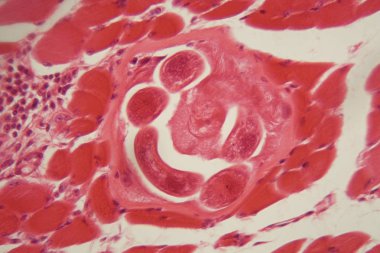 Mikroskop altında kas dokusunda Trichinella spiralis larvaları.