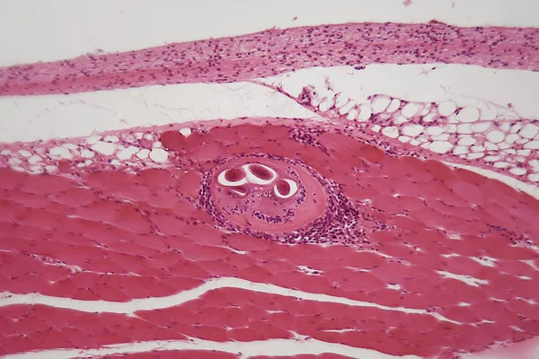 Larwy trichinella spiralis w tkance mięśniowej pod mikroskopem. — Zdjęcie stockowe