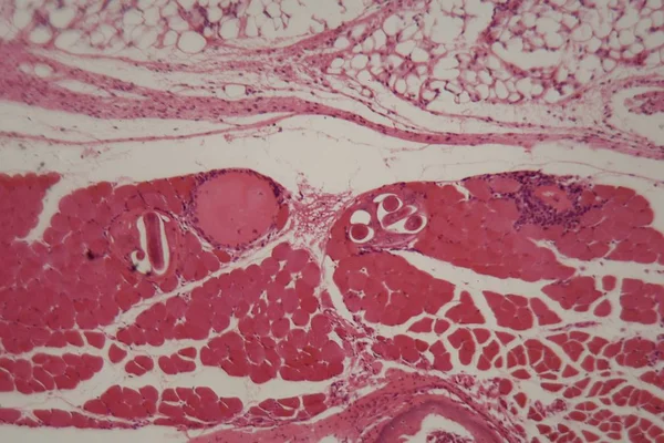 Trichinella spiralis ตัวอ่อนในเนื้อเยื่อกล้ามเนื้อภายใต้กล้องจุลทรรศน์ . — ภาพถ่ายสต็อก