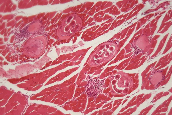 Mikroskop altında kas dokusunda Trichinella spiralis larvaları.
