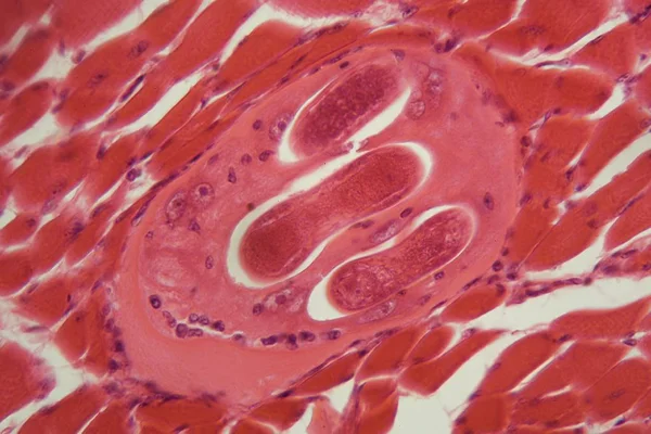 Личинки спіралі трихінелли в м'язовій тканині під мікроскопом . — стокове фото