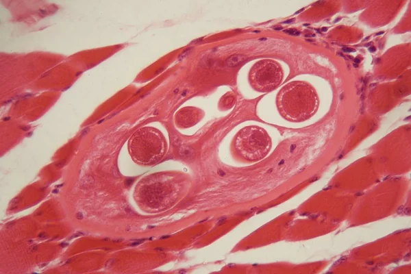 Larvas de triquinas espirais no tecido muscular ao microscópio . — Fotografia de Stock