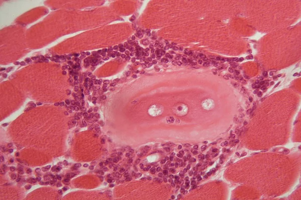 Svalovina spiralis larvy ve svalové tkáni pod mikroskopem. — Stock fotografie