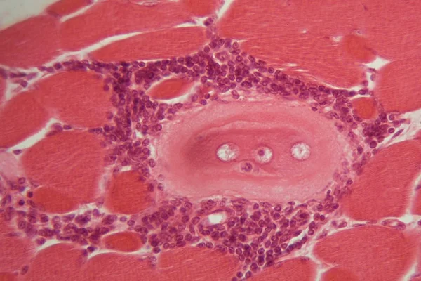 Larwy trichinella spiralis w tkance mięśniowej pod mikroskopem. — Zdjęcie stockowe