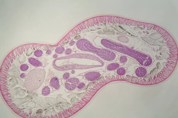 Gusano nematodo parásito (Ascaris sp.) bajo el microscopio — Foto de Stock