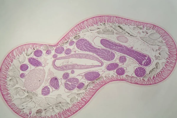 Verme nematoide parasita (Ascaris sp.) sob o microscópio — Fotografia de Stock