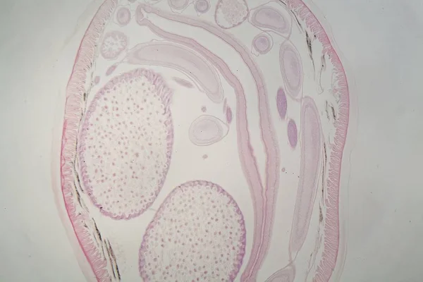 Verme nematoide parasita (Ascaris sp.) sob o microscópio — Fotografia de Stock