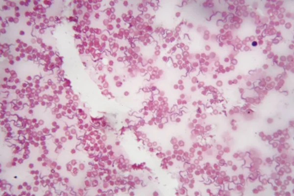 人体血液与锥虫病布鲁氏菌的显微镜照片是导致非洲锥虫病的寄生虫 — 图库照片