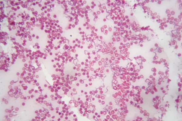 Microscopio foto de sangre humana con Trypanosoma brucei un parásito responsable de la tripanosomiasis africana —  Fotos de Stock