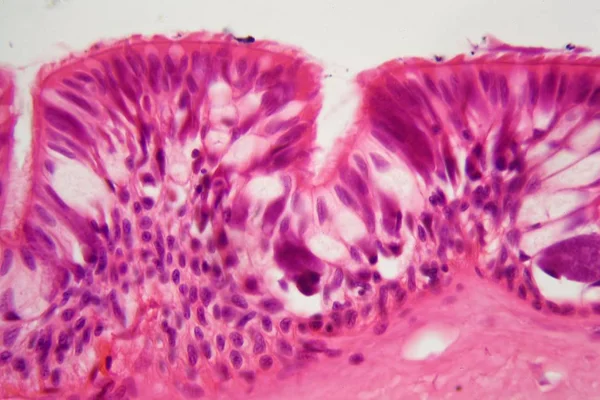Epitelio ciliado bajo el microscopio . — Foto de Stock