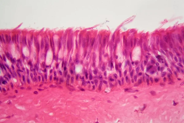 Ciliated hám a Mikroszkóp alatt. — Stock Fotó