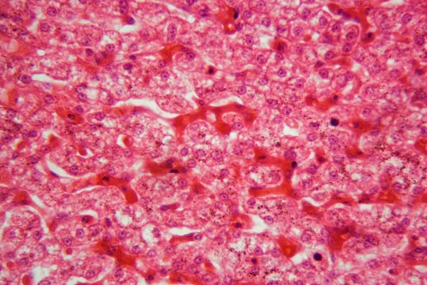 Células hepáticas ao microscópio — Fotografia de Stock