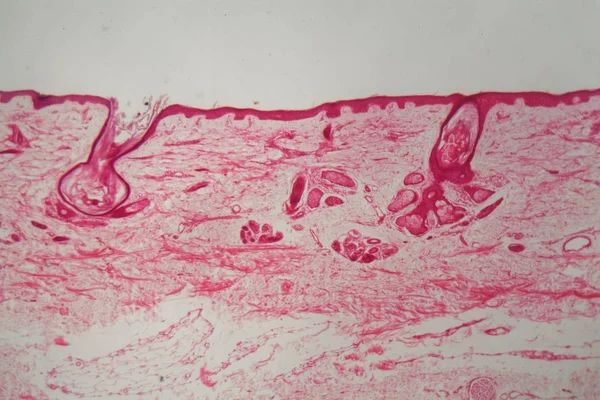 Mikroskop altında foliküllü cilt