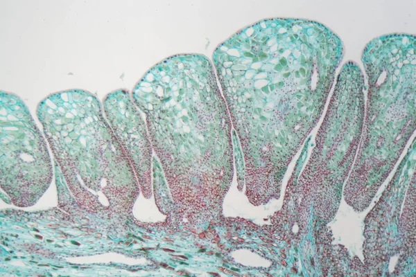 Cono de pino hembra bajo el microscopio — Foto de Stock