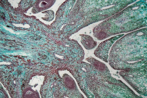 Żeńskie stożek sosny pod mikroskopem — Zdjęcie stockowe