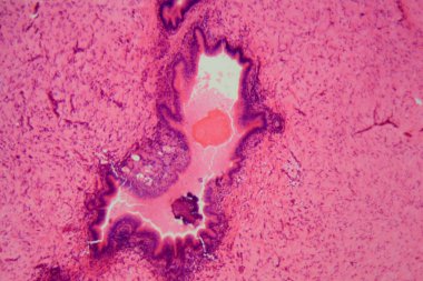 Coccidia parazitleri olan bir rabit karaciğer hücreleri.