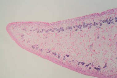 Mikroskop altında ortak bir karaciğer şans (Fasciola) Bölümü