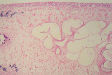 Mikroskop altında ortak bir karaciğer şans (Fasciola) Bölümü